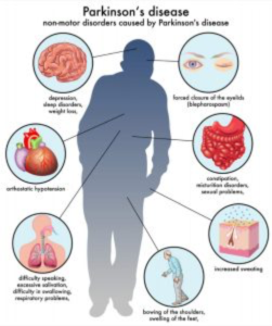 Parkinson’s disease disorders. Via Kentucky Neurology and Rehab